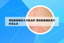 掌趾膿皰病多久才能治好 掌趾膿皰病反復(fù)不好怎么辦