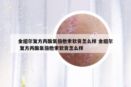金紐爾復(fù)方丙酸氯倍他索軟膏怎么樣 金紐爾 復(fù)方丙酸氯倍他索軟膏怎么樣