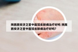 陜西西安濟(jì)之堂中醫(yī)館皮膚病治療好嗎 陜西西安濟(jì)之堂中醫(yī)館皮膚病治療好嗎?