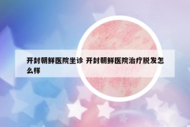 開(kāi)封朝鮮醫(yī)院坐診 開(kāi)封朝鮮醫(yī)院治療脫發(fā)怎么樣