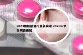 2023銀屑病治療最新突破 2020年銀屑病新進(jìn)展