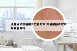 兒童點(diǎn)滴銀屑病長效青霉素 銀屑病掛青霉素吊瓶管用嗎