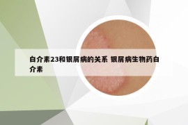 白介素23和銀屑病的關(guān)系 銀屑病生物藥白介素