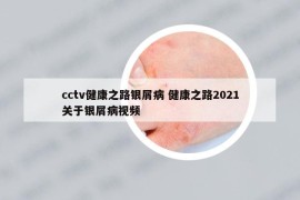 cctv健康之路銀屑病 健康之路2021關于銀屑病視頻