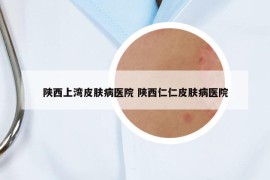 陜西上灣皮膚病醫(yī)院 陜西仁仁皮膚病醫(yī)院