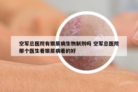 空軍總醫(yī)院有銀屑病生物制劑嗎 空軍總醫(yī)院那個(gè)醫(yī)生看銀屑病看的好
