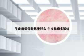 牛皮癬做仰臥起坐好么 牛皮膚癬多鍛煉