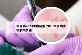 銀屑病2023生物制劑 2019銀屑病生物制劑價格