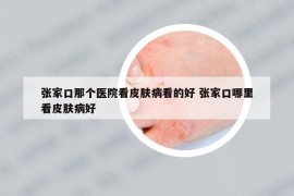 張家口那個醫(yī)院看皮膚病看的好 張家口哪里看皮膚病好