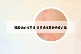 銀屑病的梅花針 銀屑病梅花針治療方法