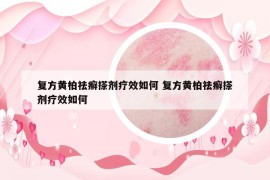 復(fù)方黃柏祛癬搽劑療效如何 復(fù)方黃柏祛癬搽劑療效如何