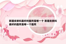 新疆皮膚科最好的醫(yī)院是哪一個(gè) 新疆皮膚科最好的醫(yī)院是哪一個(gè)醫(yī)院