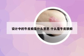 設(shè)計中的牛皮癬是什么意思 什么是牛皮膚癬