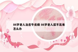 86歲老人治愈牛皮癬 86歲老人尿不出來怎么辦