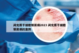 間充質(zhì)干細(xì)胞銀屑病2023 間充質(zhì)干細(xì)胞銀屑病的案例