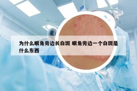 為什么眼角旁邊長白斑 眼角旁邊一個(gè)白斑是什么東西
