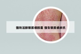 強(qiáng)效活膚銀屑病膠囊 強(qiáng)生銀屑病單抗