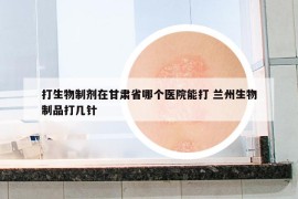 打生物制劑在甘肅省哪個醫(yī)院能打 蘭州生物制品打幾針