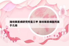 濰坊銀屑病研究院是三甲 濰坊銀屑病醫(yī)院屬于幾級(jí)