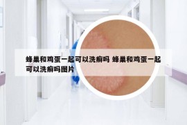 蜂巢和雞蛋一起可以洗癬嗎 蜂巢和雞蛋一起可以洗癬嗎圖片