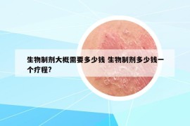 生物制劑大概需要多少錢 生物制劑多少錢一個(gè)療程?