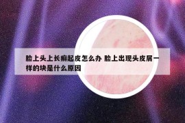 臉上頭上長(zhǎng)癬起皮怎么辦 臉上出現(xiàn)頭皮屑一樣的塊是什么原因