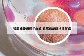 銀屑病能喝梔子水嗎 銀屑病能喝祛濕茶嗎