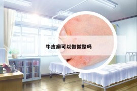 牛皮癬可以做微整嗎