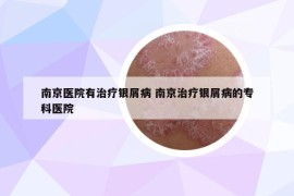 南京醫(yī)院有治療銀屑病 南京治療銀屑病的?？漆t(yī)院