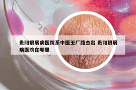 貴陽(yáng)銀屑病醫(yī)院系中醫(yī)玉廠路杰出 貴陽(yáng)銀屑病醫(yī)院在哪里