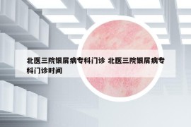 北醫(yī)三院銀屑病專(zhuān)科門(mén)診 北醫(yī)三院銀屑病專(zhuān)科門(mén)診時(shí)間