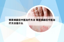 銀屑病最佳中醫(yī)治療方法 銀屑病最佳中醫(yī)治療方法是什么