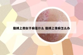 胳膊上類似于癬是什么 胳膊上像癬怎么辦