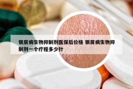 銀屑病生物抑制劑醫(yī)保后價格 銀屑病生物抑制劑一個療程多少針