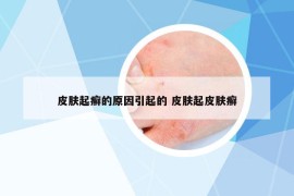 皮膚起癬的原因引起的 皮膚起皮膚癬