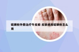 硫磺粉外敷治療牛皮癬 皮膚病用硫磺粉怎么用