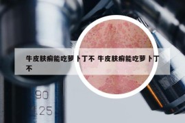 牛皮膚癬能吃蘿卜丁不 牛皮膚癬能吃蘿卜丁不