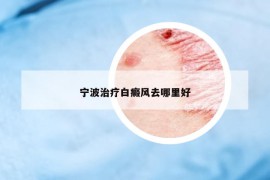 寧波治療白癜風去哪里好