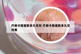 療癬卡西甫散多久見效 療癬卡西甫散多久見效果