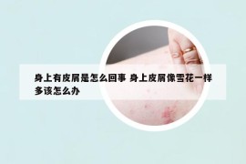 身上有皮屑是怎么回事 身上皮屑像雪花一樣多該怎么辦