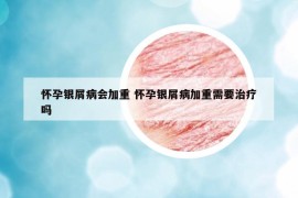 懷孕銀屑病會(huì)加重 懷孕銀屑病加重需要治療嗎