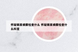 懷疑銀屑病要檢查什么 懷疑銀屑病要檢查什么科室