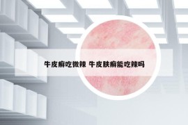牛皮癬吃微辣 牛皮膚癬能吃辣嗎