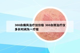 308白癜風(fēng)治療儀價(jià)格 308白斑治療儀多長(zhǎng)時(shí)間為一療程