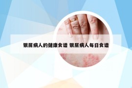 銀屑病人的健康食譜 銀屑病人每日食譜