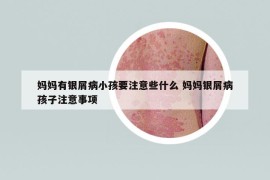 媽媽有銀屑病小孩要注意些什么 媽媽銀屑病孩子注意事項(xiàng)