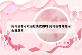 阿司匹林可以治療頭皮屑嗎 阿司匹林片能治頭皮屑嗎