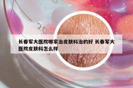 長(zhǎng)春軍大醫(yī)院哪家治皮膚科治的好 長(zhǎng)春軍大醫(yī)院皮膚科怎么樣
