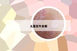 兒童出牛皮癬