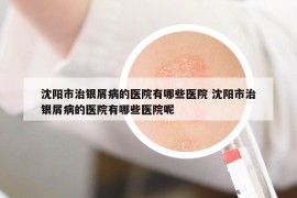 沈陽市治銀屑病的醫(yī)院有哪些醫(yī)院 沈陽市治銀屑病的醫(yī)院有哪些醫(yī)院呢
